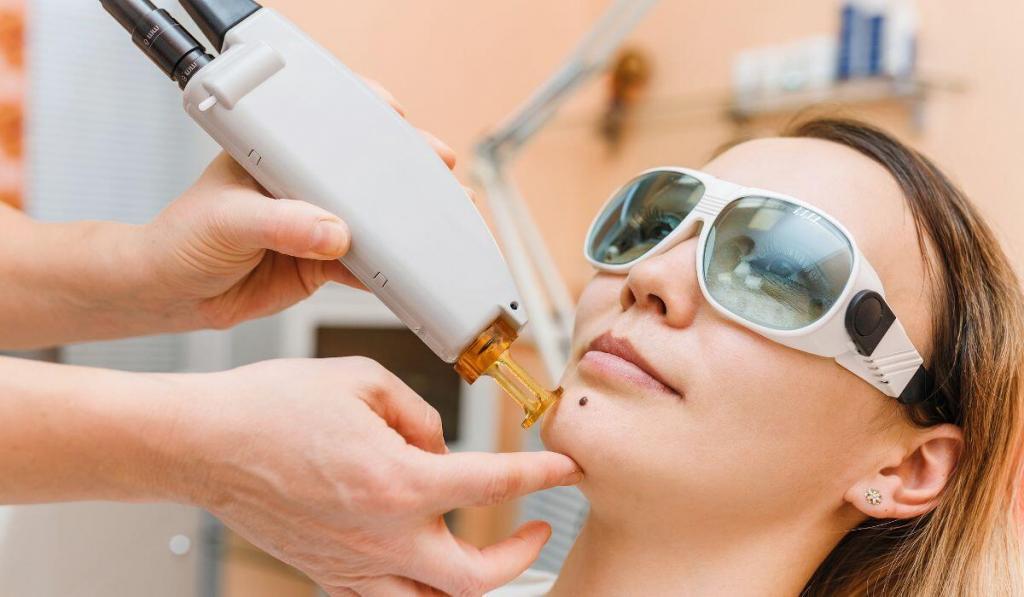 a laser bing used on a woman face