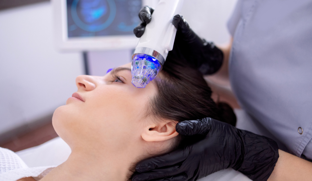 microneedling - a light-skinned woman getting microneedling done on her face